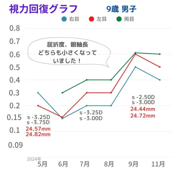 視力回復グラフst
